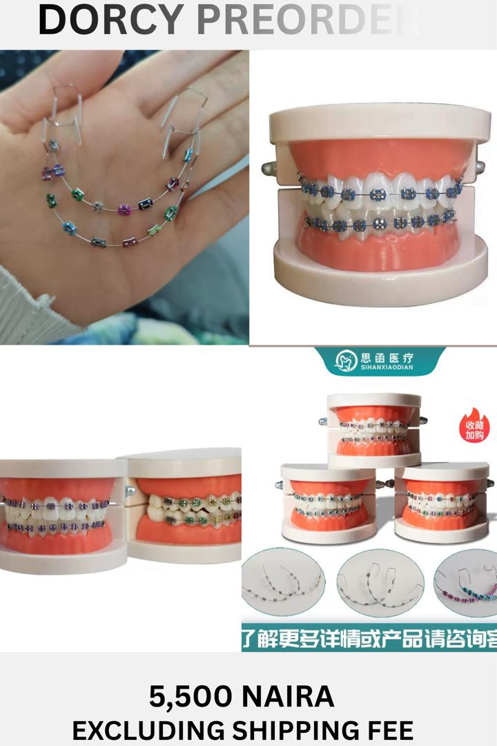 Tooth Braces